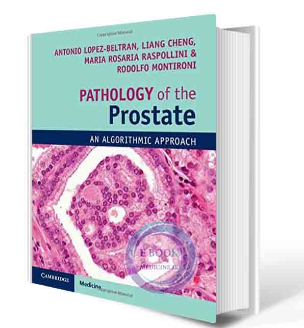 دانلود کتاب Pathology of the Prostate: An Algorithmic Approach 1st  2018( PDF)